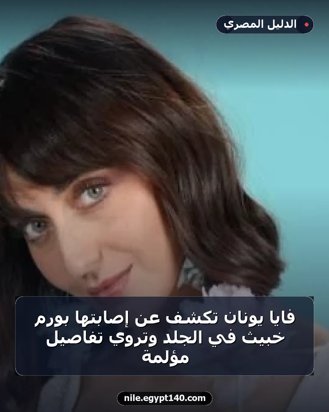 فايا يونان تكشف عن إصابتها بورم خبيث في الجلد وتروي تفاصيل مؤلمة