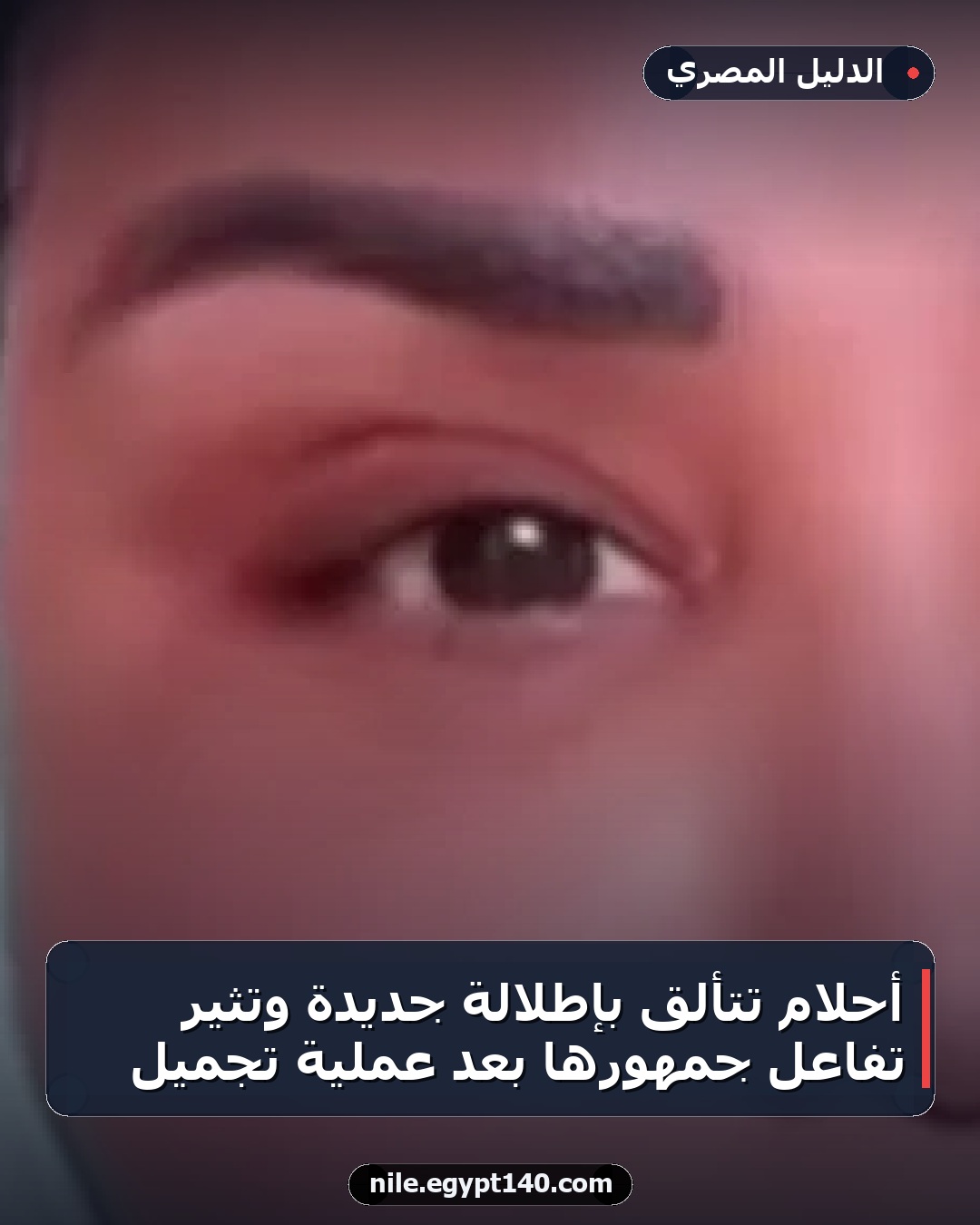أحلام تتألق بإطلالة جديدة وتثير تفاعل جمهورها بعد عملية تجميل