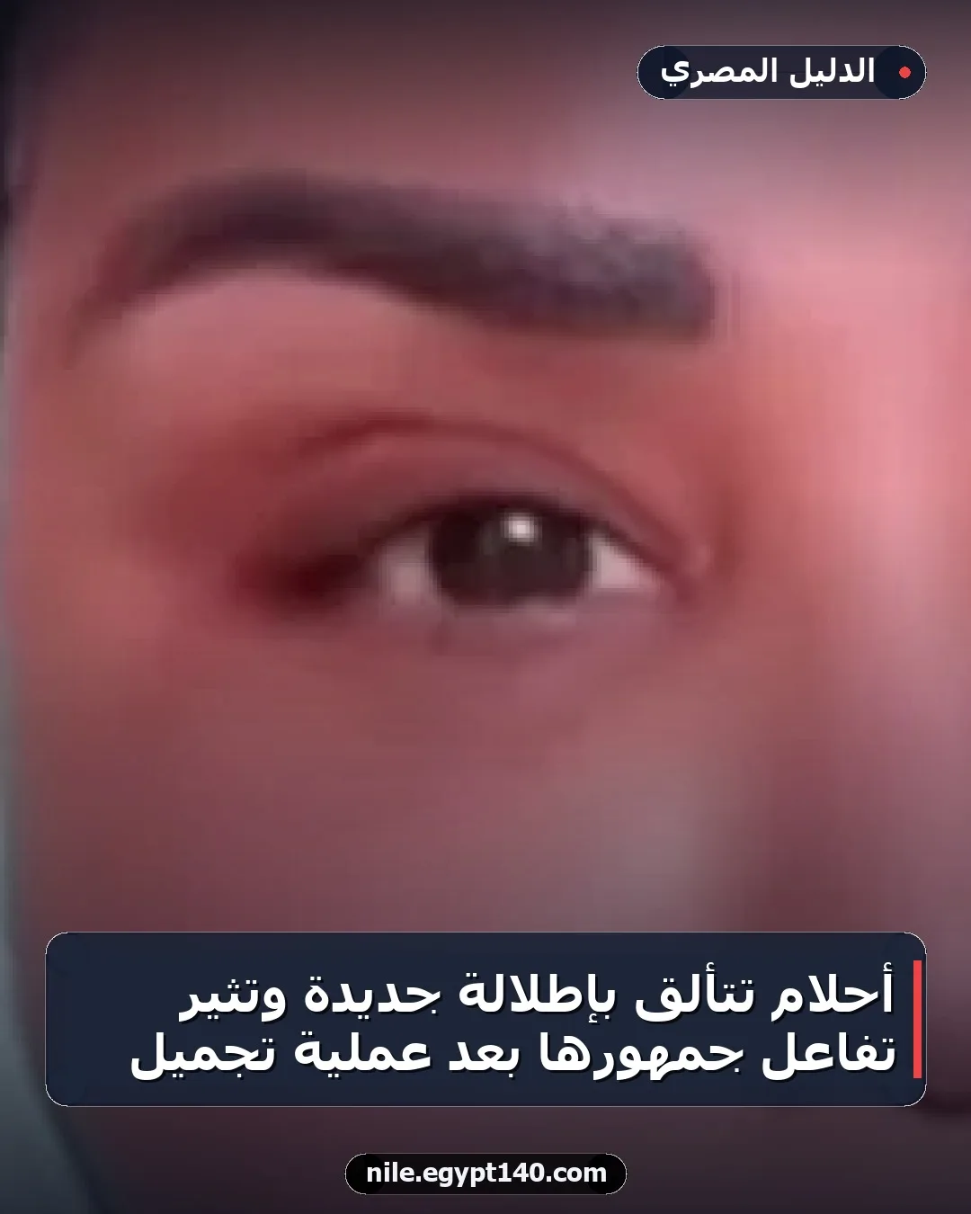 أحلام تتألق بإطلالة جديدة وتثير تفاعل جمهورها بعد عملية تجميل