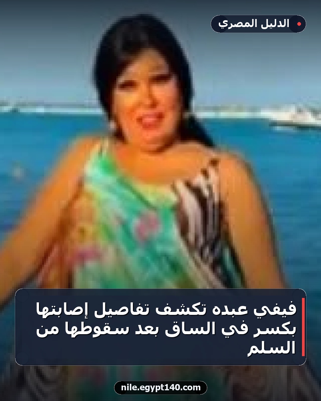 فيفي عبده تكشف تفاصيل إصابتها بكسر في الساق بعد سقوطها من السلم